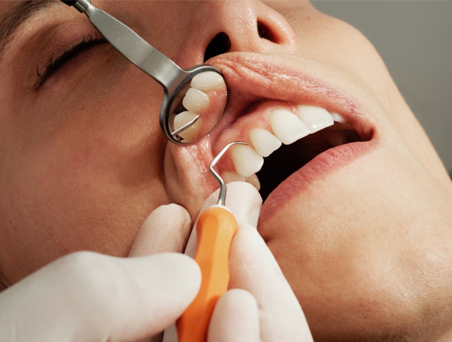 Everything you need to know about dental malpractice