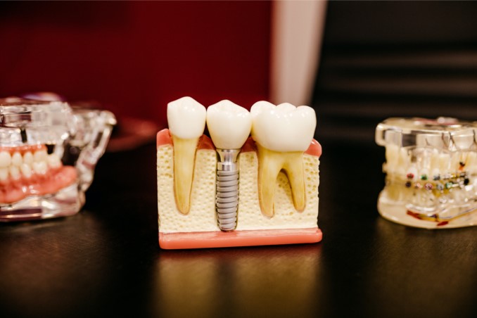 dental malpractice cases examples